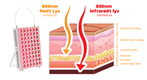 light therapy for tennis elbow